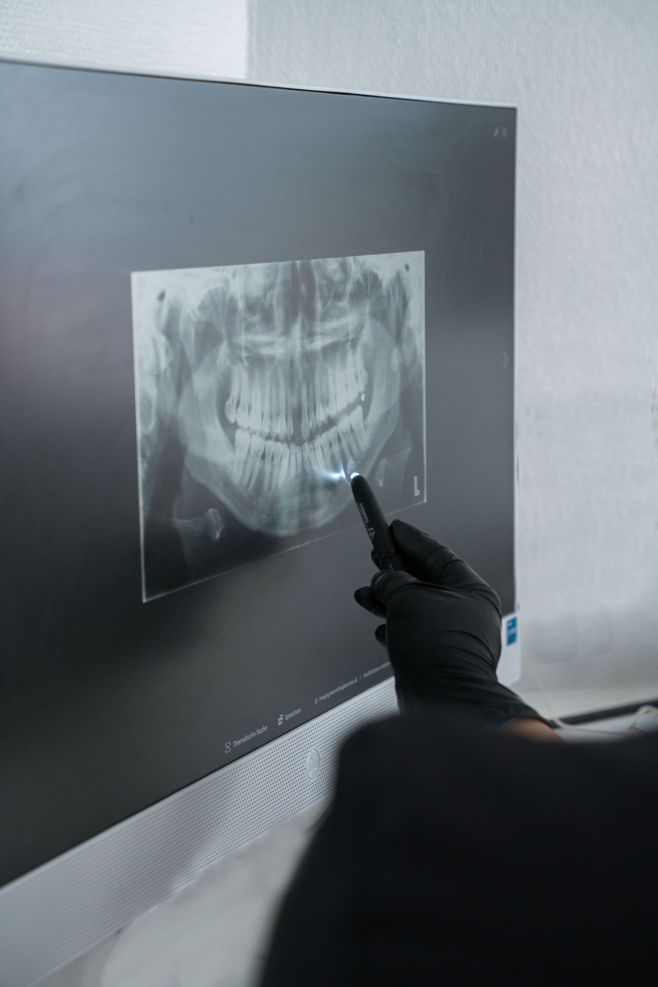 Digitales strahlenreduziertes Röntgen Zahnarzt Praxis Frankfurt Praunheim